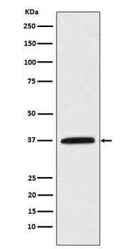 Kallikrein 5 Rabbit Monoclonal Antibody