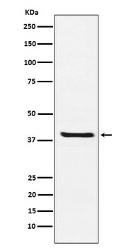 Arg2 Rabbit Monoclonal Antibody