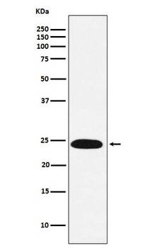 VPS28 Rabbit Monoclonal Antibody