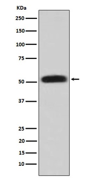Glycerol kinase Rabbit Monoclonal Antibody