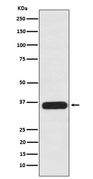 PDLIM1 Rabbit Monoclonal Antibody