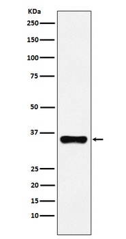 HOXA9 Rabbit Monoclonal Antibody