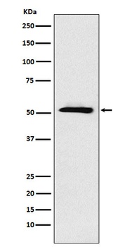 ETV6 Rabbit Monoclonal Antibody