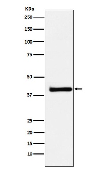 XRCC3 Rabbit Monoclonal Antibody