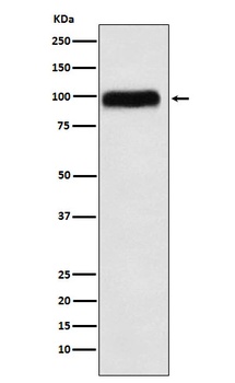 SERPING1 Rabbit Monoclonal Antibody