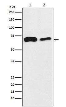 SLC27A4 / FATP4 Rabbit Monoclonal Antibody