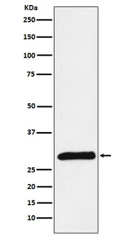 PRSS2 Rabbit Monoclonal Antibody