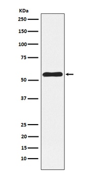 NLK Rabbit Monoclonal Antibody