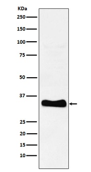 Monoacylglycerol Lipase Rabbit Monoclonal Antibody