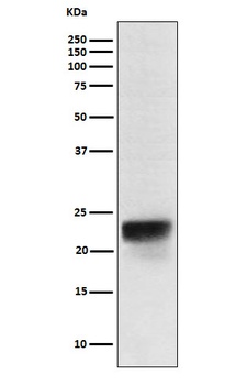 FSH beta Rabbit Monoclonal Antibody
