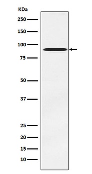ATRIP Rabbit Monoclonal Antibody