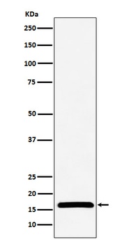 NME2 Rabbit Monoclonal Antibody