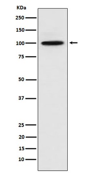 CTNNA3 Rabbit Monoclonal Antibody