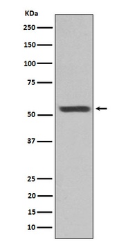Cytokeratin 12 Rabbit Monoclonal Antibody
