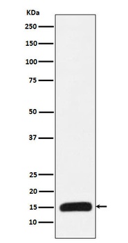Histone H3 (mutated K27 Met) Rabbit Monoclonal Antibody