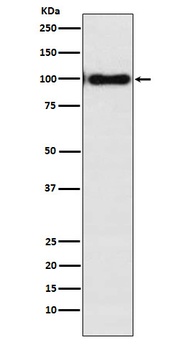 Desmocollin-3 Rabbit Monoclonal Antibody
