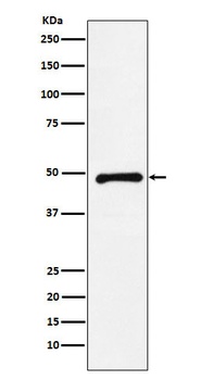 CTBP2 Rabbit Monoclonal Antibody