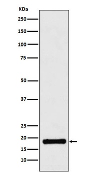 UBE2B Rabbit Monoclonal Antibody