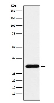 GTF2F2 Rabbit Monoclonal Antibody