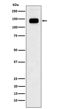 GTF2I Rabbit Monoclonal Antibody