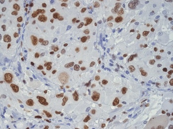 Anti-TDP43 Rabbit Monoclonal Antibody