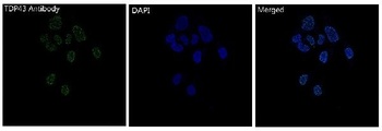 Anti-TDP43 Rabbit Monoclonal Antibody