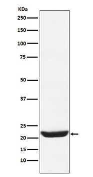 NCS1 Rabbit Monoclonal Antibody