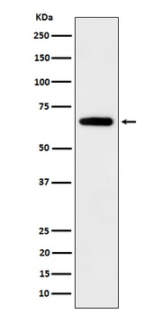 IGF2BP2 Rabbit Monoclonal Antibody