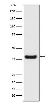 Erlin-2 Rabbit Monoclonal Antibody