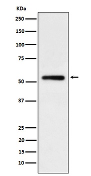 Human IgG1 Rabbit Monoclonal Antibody