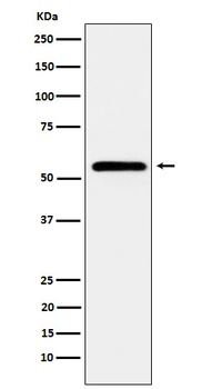 CaMKII Rabbit Monoclonal Antibody