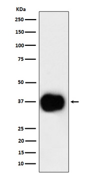 CD79b Rabbit Monoclonal Antibody