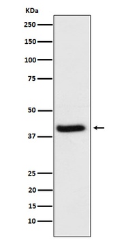 HFE Rabbit Monoclonal Antibody