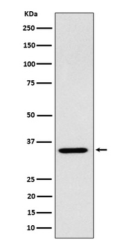 ARPC2 Rabbit Monoclonal Antibody