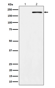 Phospho-ErbB2 (Y1139) Rabbit Monoclonal Antibody