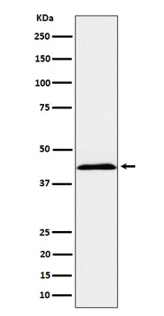 NCTR2 Rabbit Monoclonal Antibody