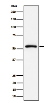 CAP1 Rabbit Monoclonal Antibody