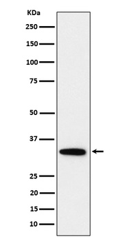 PPP6C Rabbit Monoclonal Antibody