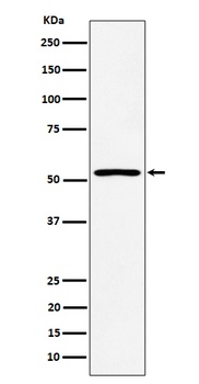 SAMM50 Rabbit Monoclonal Antibody