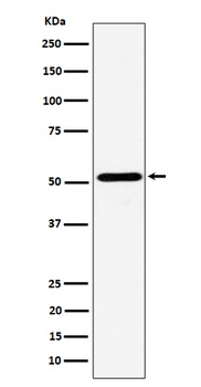 NPY5R Rabbit Monoclonal Antibody
