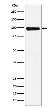 CHM Rabbit Monoclonal Antibody