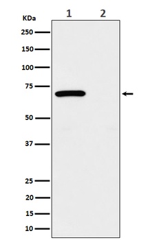 Phospho-Chk2 (T68) Rabbit Monoclonal Antibody