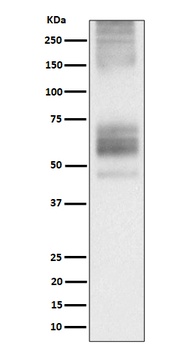 Somatostatin Receptor 1 Rabbit Monoclonal Antibody