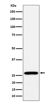 RPL13 Rabbit Monoclonal Antibody