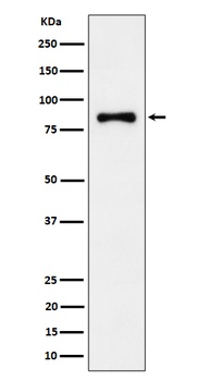 ALDH16A1 Rabbit Monoclonal Antibody