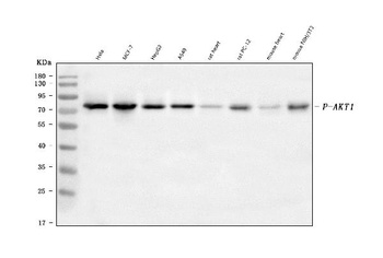 Phospho-TAK1 (S439) Rabbit Monoclonal Antibody
