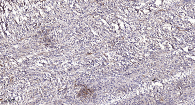 PTPRQ Rabbit Polyclonal Antibody