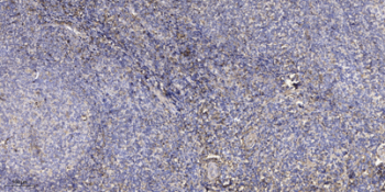 mScarlet Rabbit Polyclonal Antibody