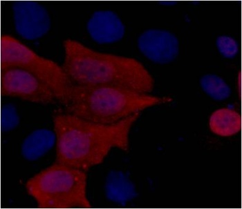 His-Tag Mouse mAb