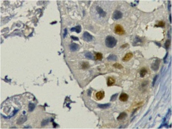PCNA Mouse mAb